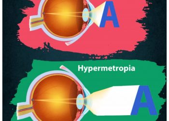 cropped-Myopia-and-Hypermetropia-1.jpg