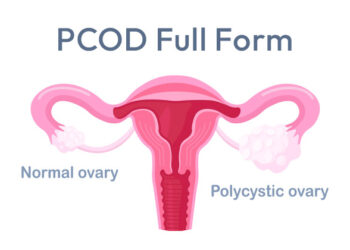 PCOD Full Form
