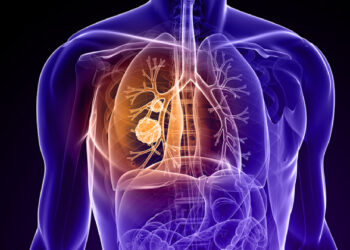 World Lung Cancer Day